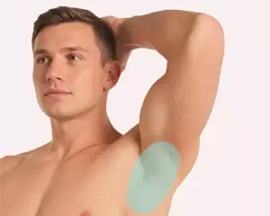 muzhskaya epilyaciya aleksandritovym lazerom podmyshechnyh vpadin
